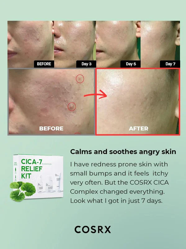 cica-7-relief-kit-3-step-cosrx-official-4 مجموعة كوزركس بيور كيكا كات 7 - الصورة 3
