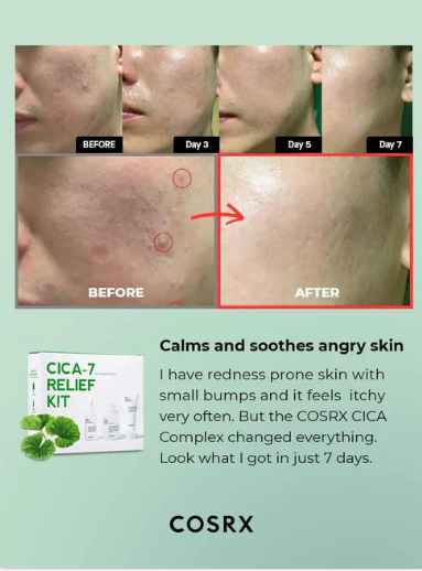 بى مجموعة COSRX Pure Fit CICA-7 - الصورة 3