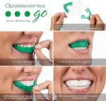 ⁦مجموعة التبييض OPALESCENCE GO MINT 10%⁩ - الصورة ⁦4⁩