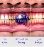 ⁦رغوة تصحيح لون الأسنان Hismile - V34⁩ - الصورة ⁦2⁩